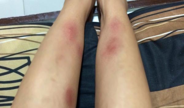 anaaadeleon's tweet photo. Proof that my lifters care for me... Tight grips won't let me fall. Maybe.. Too tight.. ๐
๐
๐
@olssoneerz #pyramidlife http://t.co/1mVerMO3ep