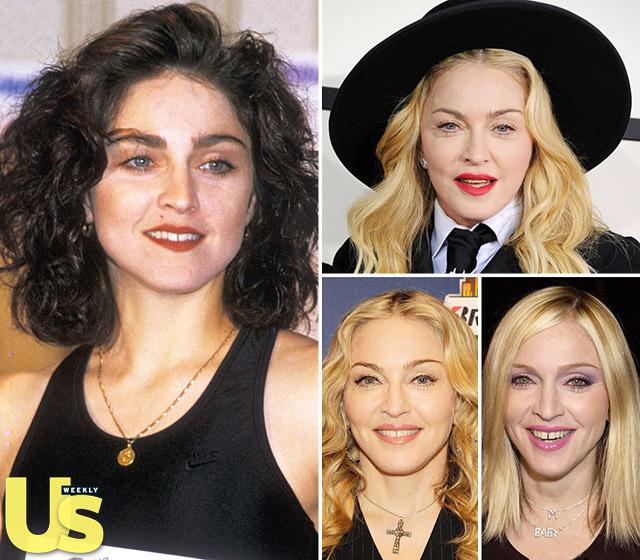 Happy 56th birthday, Madonna! See how the Queen of Pop has evolved over the years:  