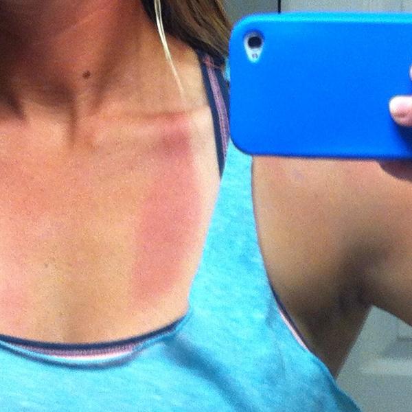 m3gs77's tweet image. Have tan lines from wearing my gold medal all day @PPFultimate #championproblems #CUC2014