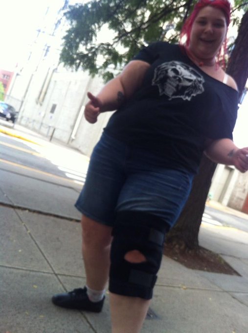 I hurt myself at the show last night so now I get a cool robot leg http://t.co/sYRaZ8OfXQ