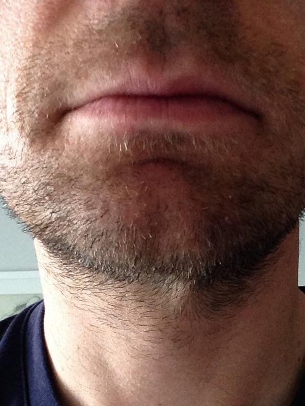 alexdeakin's tweet photo. Back to work this pm/eve so the 10 day face fuzz must go #weakbeard http://t.co/bMXVNA4QB1
