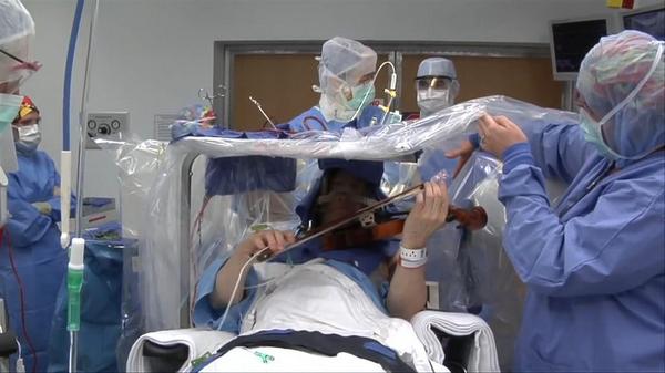 Mira cómo un violinista toca mientras le operan en el cerebro buff.ly/1ArWgIW
