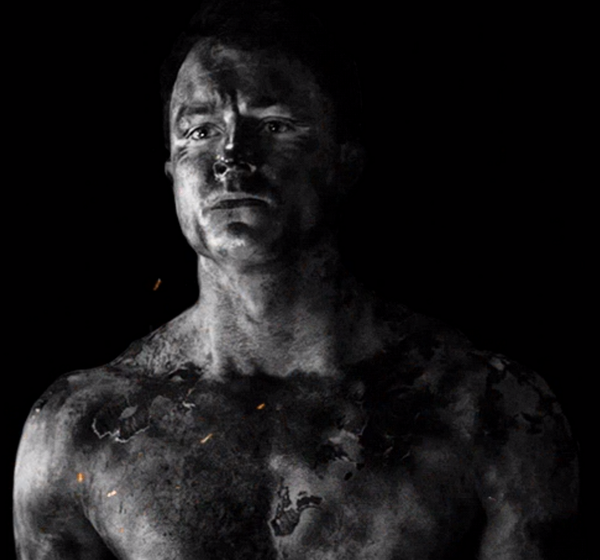 StilesHaleX's tweet photo. I volunteer to put aloe vera all over his sexy burned up body. #Parrish http://t.co/xzKmS977O1