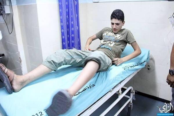 khawajaNNInews's tweet image. The injured that just arrived to the hospital from Israeli attacks in #Gaza Strip. 
#SupportForGaza
 #PrayForGaza http://t.co/ZQslKLEBKh"