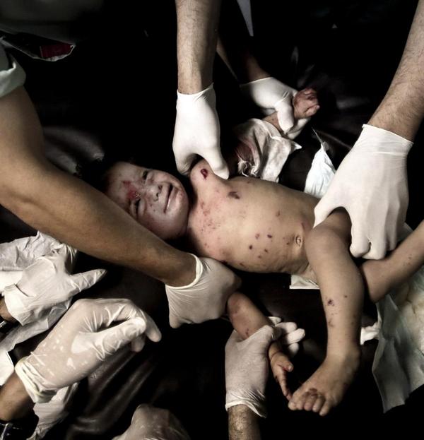 cfl071237's tweet image. Child affectedby the choas in gaza #FreeGaza