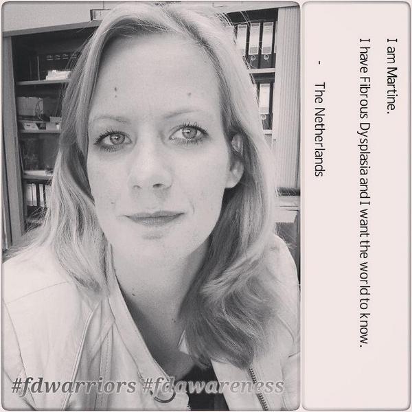 Mar10eD's tweet photo. I am Martine. I have Fibrous Dysplasia and I want the world to know... #fdwarriors #fdawareness @ZeldzameZiekten http://t.co/0tTmAn2U5u