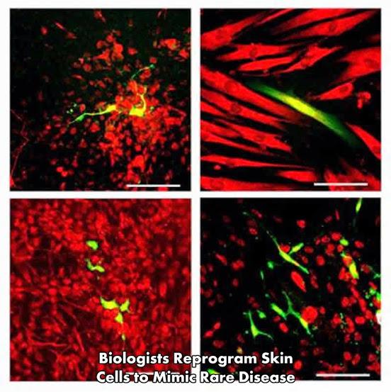 NeuroscienceNew's tweet photo. Biologists Reprogram Skin Cells to Mimic Rare Disease #science http://t.co/pCpHr5h4hm. http://t.co/ZDc4yD2jfm