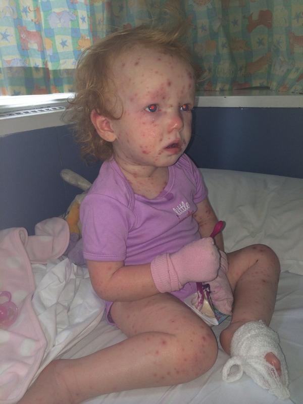LeighLomas's tweet photo. My brave sweetheart 💔😢 http://t.co/zsbs4ldufm