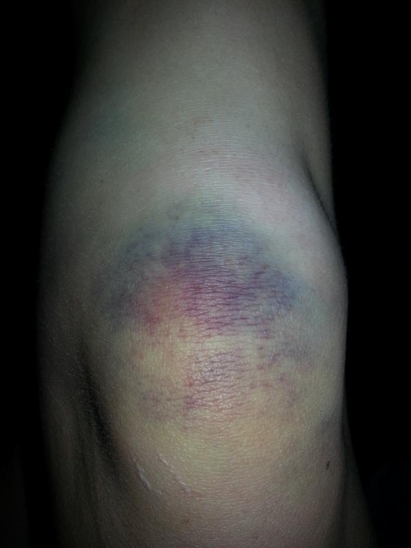 Dancer Problems tweet media