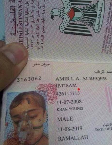 AliSiamPress's tweet photo. الطفل أمير الرقب من غزة أصيب بقصف لمنزلهم
استدعت حالته علاجه بالخارج ولا يملك جواز سفر
فإلتقطت له هذه الصورة للباسبور http://t.co/Ft0j8jro6Z