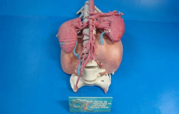 3D Printing Aids Spinal Surgery in Brazil to Remove Huge Tumor &amp; 5 Vertebrae From 12 yo Girl - 3dprint.com/12750/3d-print…