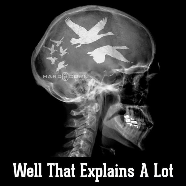 LegIron11's tweet image. 