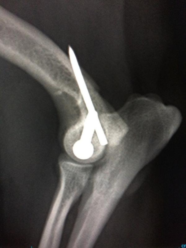 agatameus's tweet photo. Fractura de codo en un Sitzsu de 4,5kg debido a una caida de un primer piso #urgentcare #traumatologiavet #vets http://t.co/SovrlijUpy