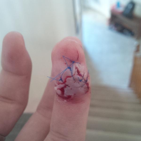 _TravisStringer's tweet image. All stitched up :)