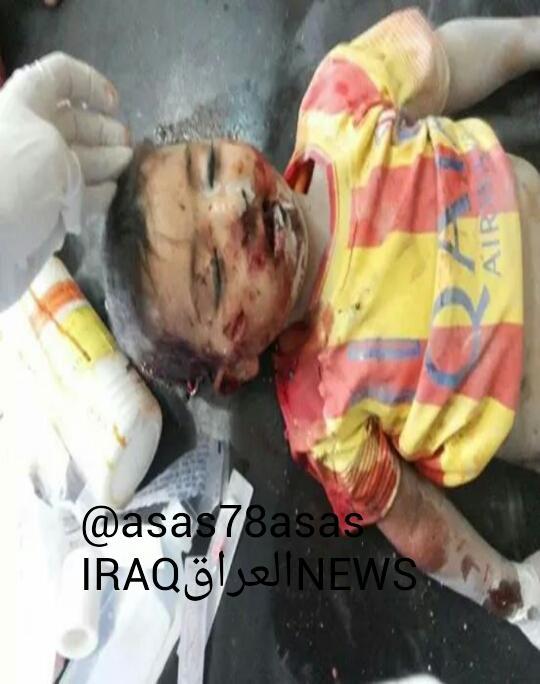 voiceofsunnis's tweet photo. الجيش الرافضي يقتل 14 طفل سني بالقصف بالبراميل المتفجرة على مستشفى الحويجة 
#العراق http://t.co/2v4kPT6p9d