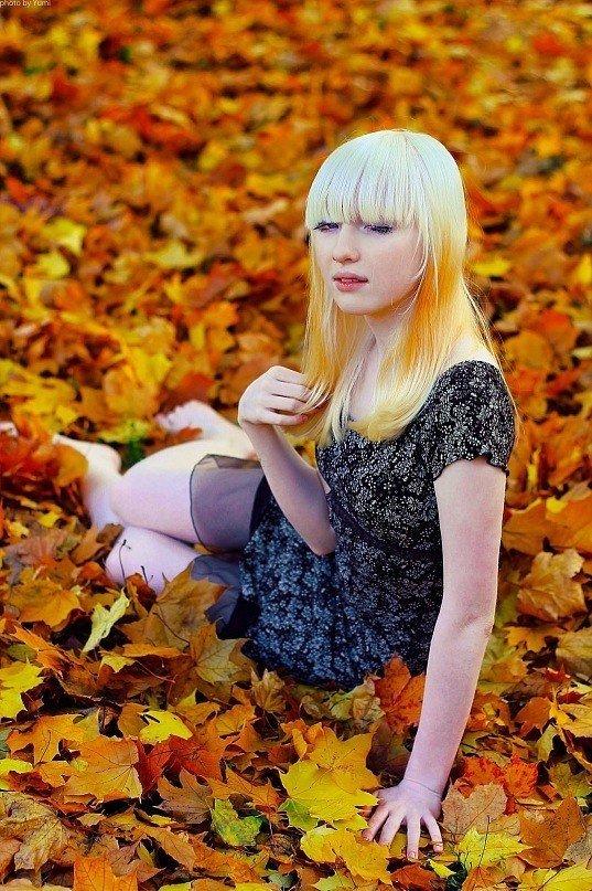 Tweets With Replies By ナスチャ 喜美 小林 アルビノモデル Albinonastya Twitter