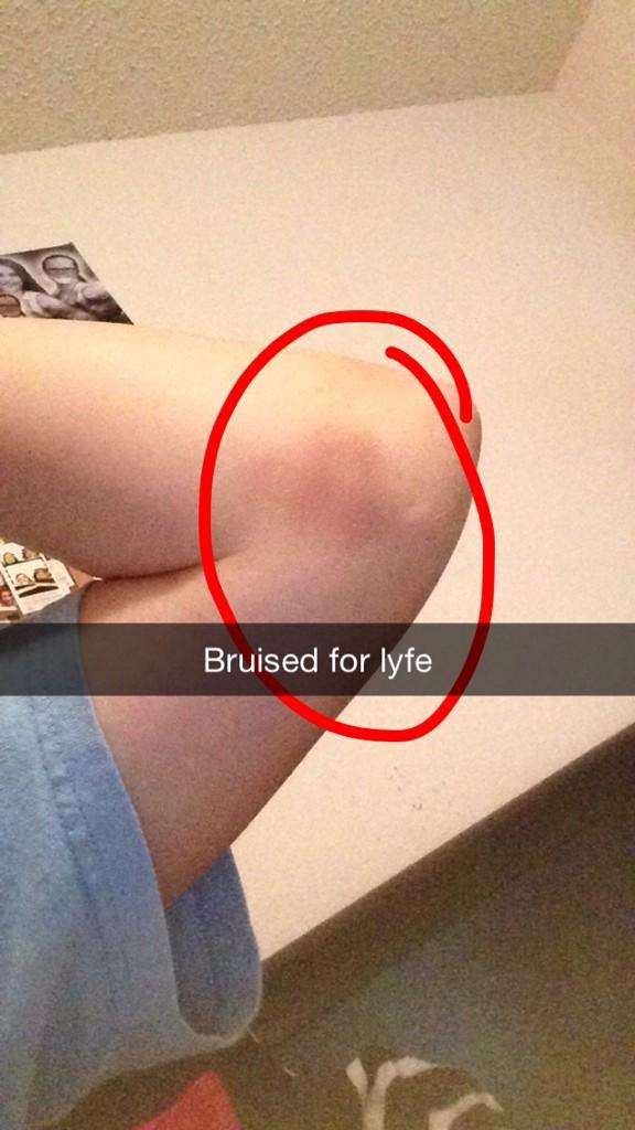 BlandKylie's tweet image. #vbprobs