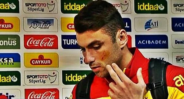 TekYurekcom's tweet photo. Burak'ın yüzüne gelen çakıya para cezası verirken istikrarınız neredeydi? Talimat gelmedi mi? @TFF_Org http://t.co/OewsbewJil