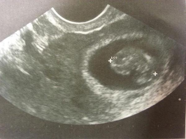mariajo4289's tweet photo. Os presento a mi peque jajajaj que sensación mas rara ver esta foto y pensar que es mi hij@ http://t.co/tJenDCP2jZ