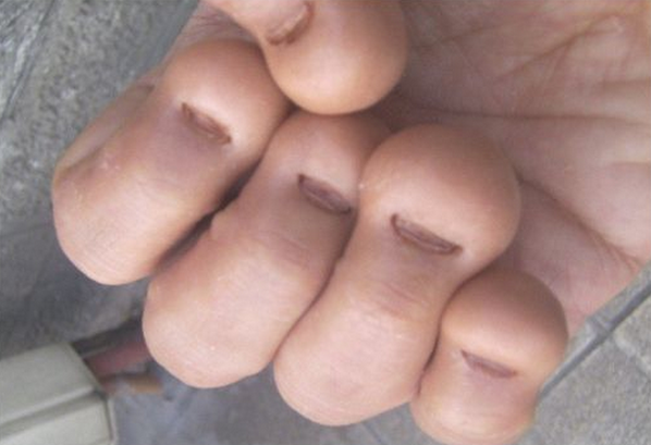 macsenlambert's tweet photo. "@SpeakComedy: I can't stand people who have fingers like these http://t.co/G64Od1tMww"@KitRoss1999 @AlexMackinnon17 @WillKember99