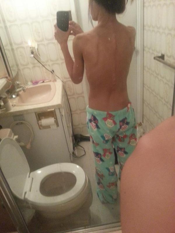 disorderly_mind's tweet image. #backslip 87 lbs