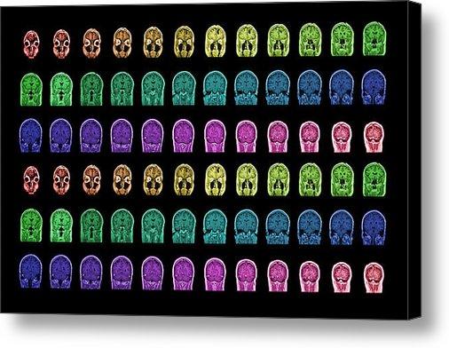 NeuronicoArt's tweet image. New artwork for sale! - "Inside the Artist\'s Mind" - fineartamerica.com/featured/insid… @fineartamerica