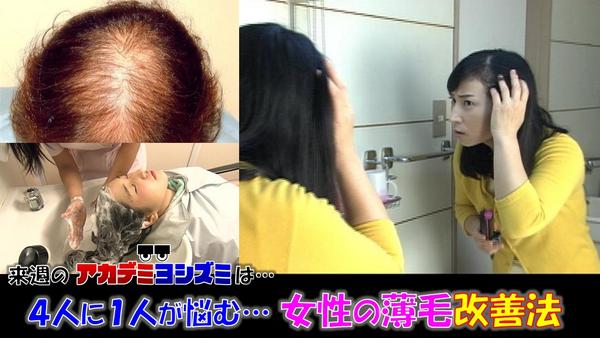 羽鳥慎一モーニングショー En Twitter 来週月曜9 1の アカデミヨシズミ は ４人に１人が悩む 女性の薄毛 に迫ります 汗や日差し等毛が抜けやすい条件が揃うこの季節 シャンプーのパッケージを確かめずに使うと 更に悪化することも 薄毛の最先端を石原良純さん