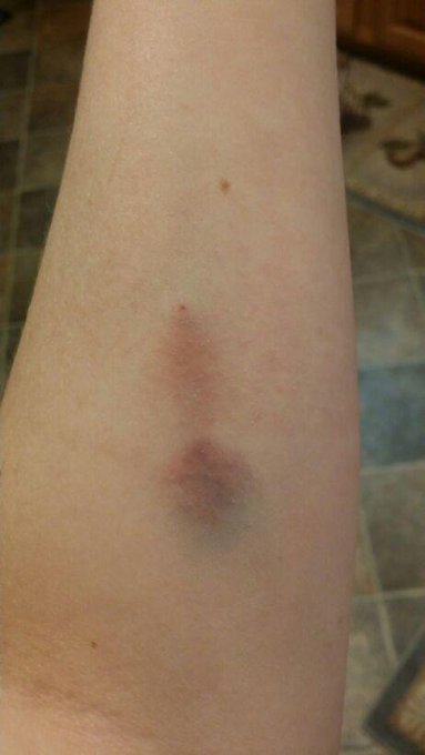 My vein almost blew today so this looks fabulous http://t.co/ncaBtU8VvV<a href="/tag/frappuccino"class="tags"><span>#frappuccino</span></a><a href="/tag/peppermintmocha"class="tags"><span>#peppermintmocha</span></a><a href="/tag/desiarnazjrjr"class="tags"><span>#desiarnazjrjr</span></a>