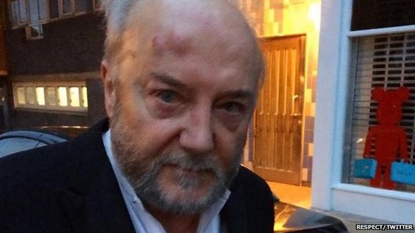 etribune's tweet photo. (World) Lawmaker who called for Israel boycott attacked in London http://t.co/CeAMEUcp0I http://t.co/npRnwkkPA7