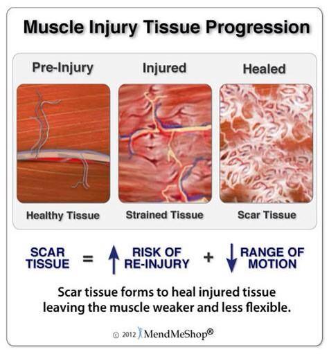 TS_Joint_Center's tweet photo. Twisted Spine &amp; Joint can help with your post-injury health. http://t.co/iYkq8KTsRz