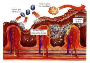 ColeanerSpa's tweet image. The Importance of Colon Cleansing - dominicanewsonline.com/news/homepage/…