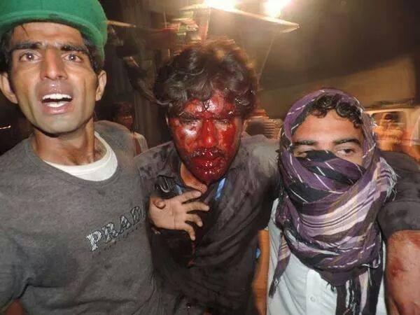 its Islamabad not #GAZA  #Islamabadmasacre  #GoNawazGo #ISPR