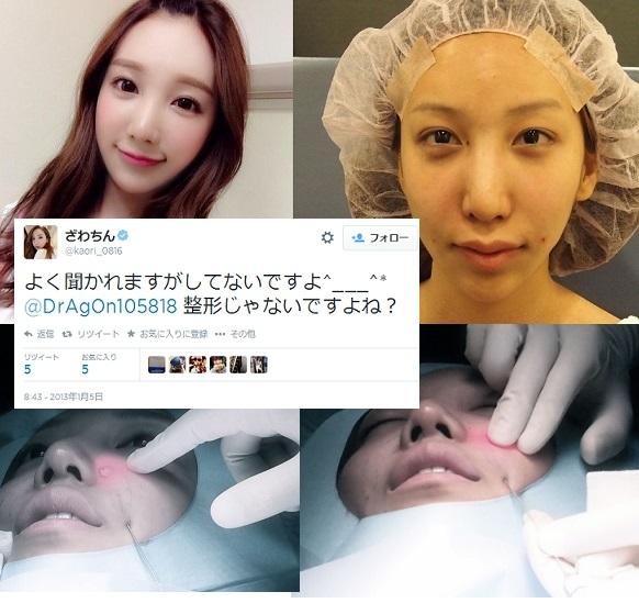 Jetstar ざわちん すっぴん 裸眼 整形後 ほほ肉の脂肪溶解 平気で嘘をつくざわちん 平気でファンを騙すざわちん メイクだけの力 笑わせるなww Http T Co Iptkf1zorb Jetstar ざわちん すっぴん 裸眼 整形後 ほほ肉の脂肪溶解 平気で嘘をつくざわちん 平気でファンを騙すざわちん メイクだけの力 笑わせるなww Http T Co Iptkf1zorb