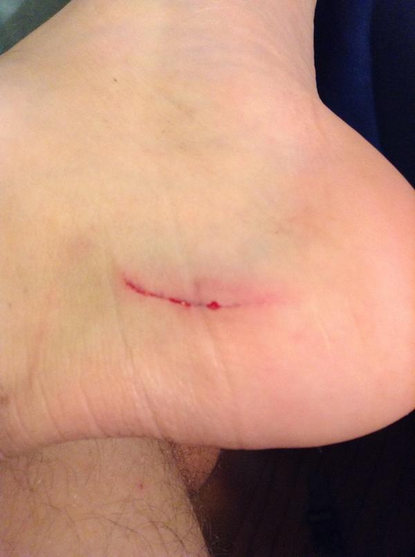 Runnercentral's tweet image. Hurray for spiking