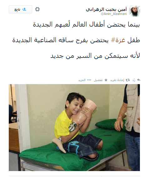 dabughoush's tweet image. #GAZA  a child holding his artificial leg