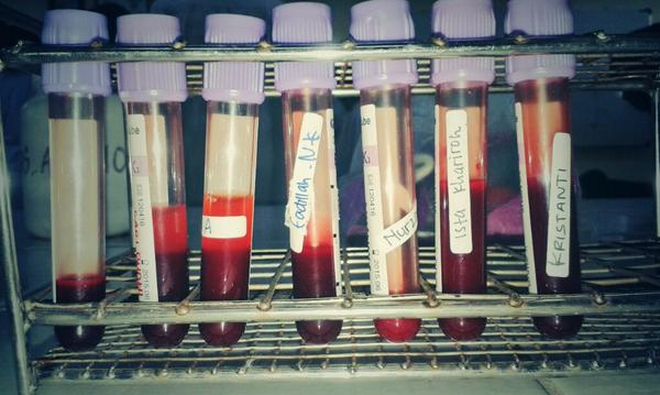 vadillah14's tweet image. #bloodsampling/vacumtube-tutup ungu.