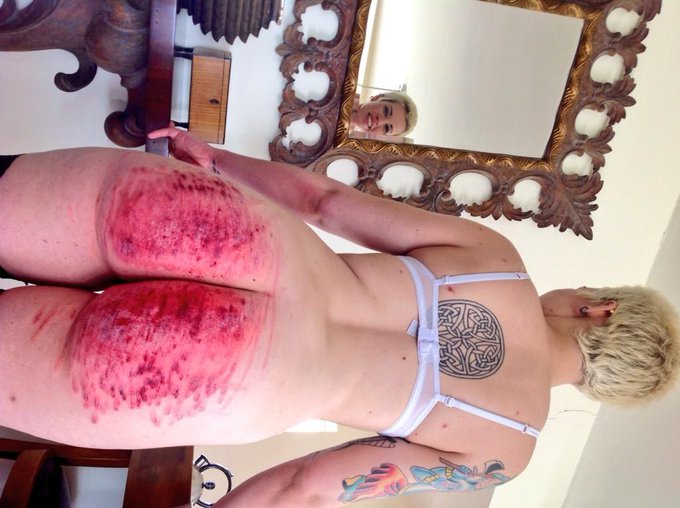 Got an incredible beating from the beautiful ilustrious @gwenmedia today. #painslut #whipped #mistress<a href="/tag/mistress"class="tags"><span>#mistress</span></a><a href="/tag/painslut"class="tags"><span>#painslut</span></a><a href="/tag/whipped"class="tags"><span>#whipped</span></a><a href="/tag/bleeding"class="tags"><span>#bleeding</span></a>