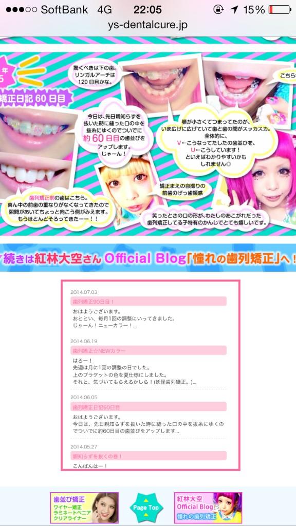 紅林大空 くれちゃんねる 歯列矯正ブログ 私が通っているワイズデンタルキュアさんのhpに 新しく 紅林大空の歯列 矯正 のページができました とっても可愛いできあがりです Hp Http T Co Gnzcefvmcq Http T Co Clamvuvqxl 紅林大空 くれちゃんねる 歯列矯正ブログ 私が通っているワイズデンタルキュアさんのhpに 新しく 紅林大空の歯列 矯正 のページができました とっても可愛いできあがりです Hp Http T Co Gnzcefvmcq Http T Co Clamvuvqxl