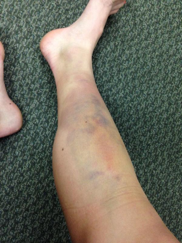 Lexi Brown (@lex_brown3) on Twitter photo "Soccer girls always have the nicest legs"
Yeah I mean I do what I can.
<a href="/SoccerGrlProbs/">SoccerGirlProblems®</a> "Soccer girls always have the nicest legs"
Yeah I mean I do what I can.
<a href="/SoccerGrlProbs/">SoccerGirlProblems®</a>