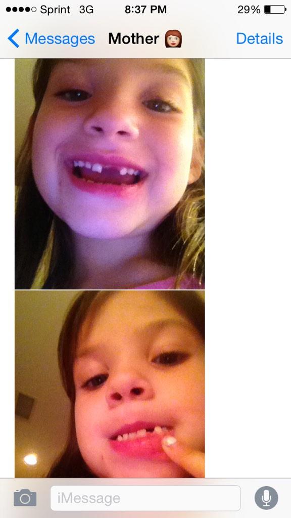 user938853814's tweet image. Big night in the Palo household #2teeth