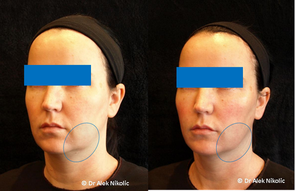 Dr Alek Nikolic tweet media