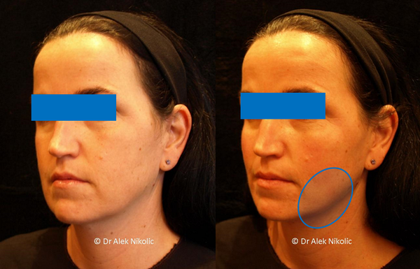 Dr Alek Nikolic tweet media