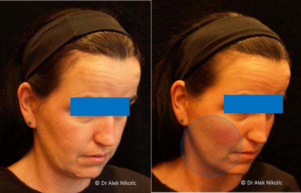 Dr Alek Nikolic tweet media