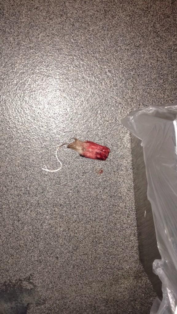 lmao4_4's tweet image. when there's a nasty ass tampon right next to the garbage @hhsproblems1 #fuckhuntington