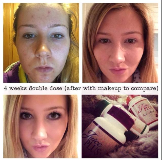Forever garcinia plus and weight loss picture 1