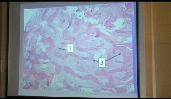 اما ربنا يسألني يوم القيامة عن شبابي فيما افنيته فاكيد اجابتي هتكون مذاكرة الماجستير وبالاخص اورال باثولوجي
يا رب