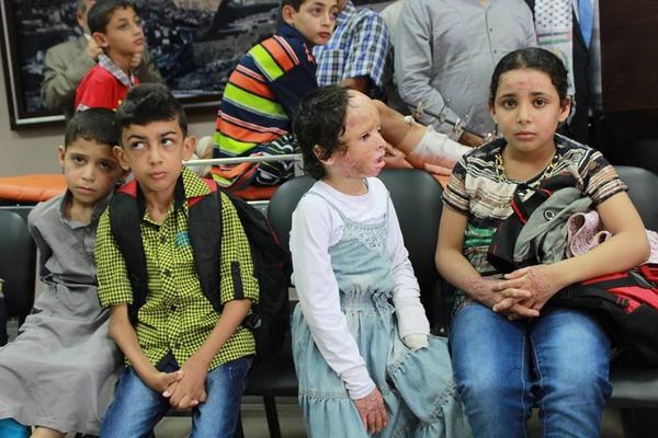 RaniaKhalek's tweet photo. 45 children injured by Israel's US-funded arsenal leave Gaza for treatment in Germany http://t.co/5aCz3xVQIb http://t.co/9WHImp4I3B