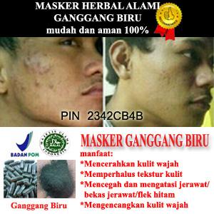 Selamat ya utk agan ini kulit nya udh sehat krn Masker organik alami