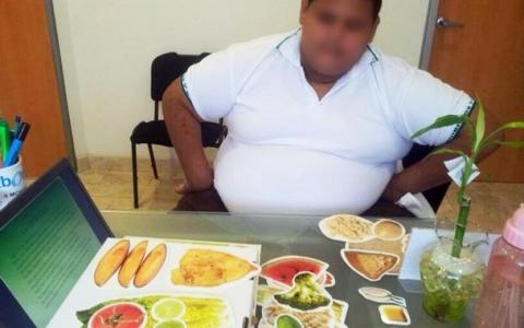 Realizan un bypass gástrico a un menor de 14 años de México que pesaba 191 kilos antena3.com/noticias/salud…