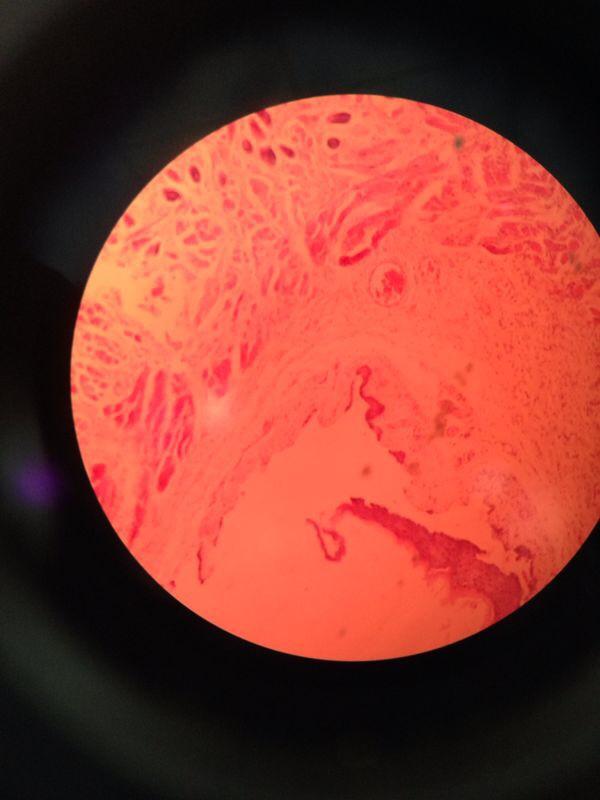 JaafarK110's tweet photo. #HistologyLab #medicine #iphonePhotographyFromMicroscope #2ndWeek http://t.co/U0D6QO2zRL